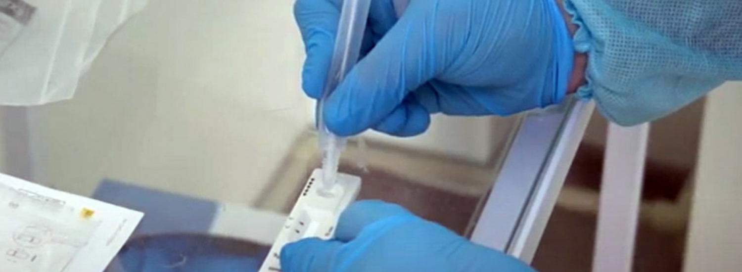 ﻿Понад 2 тисяч осіб здали тест на антиген коронавірусу SARS-CoV-2 на КПВВ «Новотроїцьке»